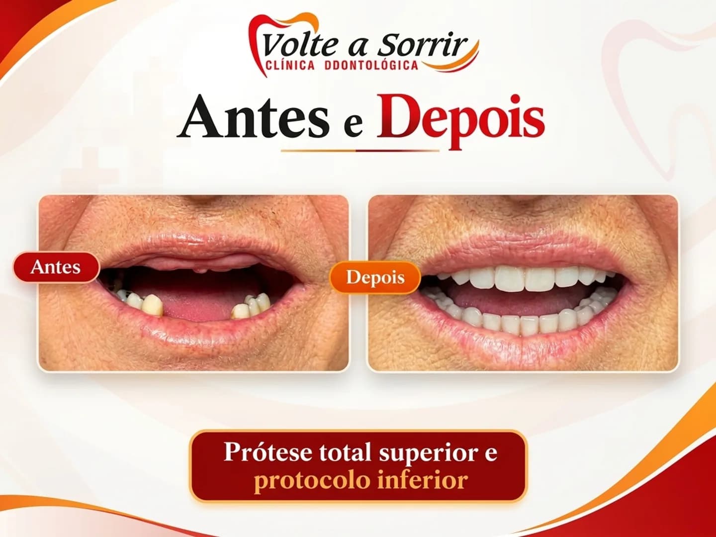 Clínica Volte a Sorrir transforma sorrisos e devolve confiança aos pacientes