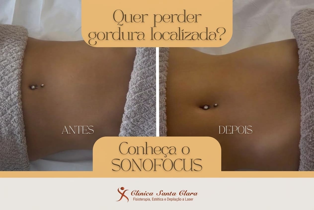 Clínica Santa Clara apresenta Sonofocus para redução de gordura localizada