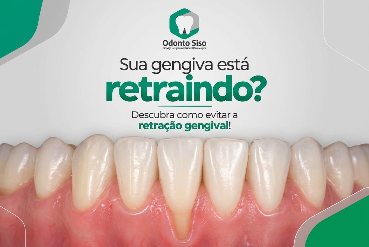 Odonto Siso alerta para os cuidados com a retração gengival
