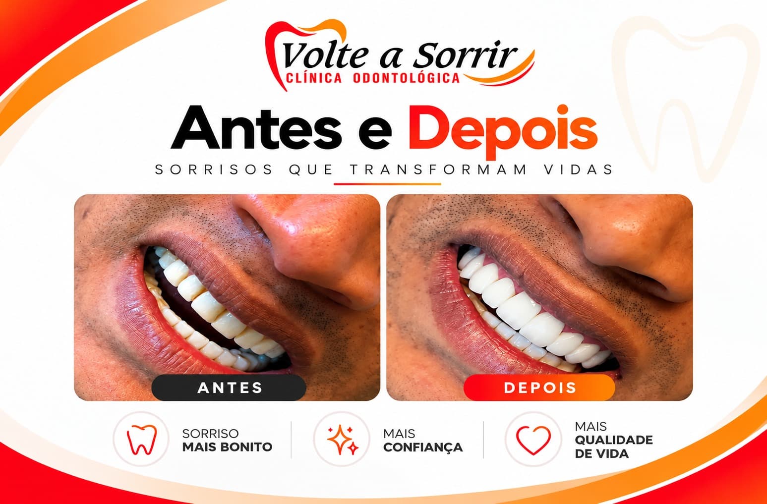 Clínica Volte a Sorrir destaca transformação de sorrisos e recuperação da autoestima